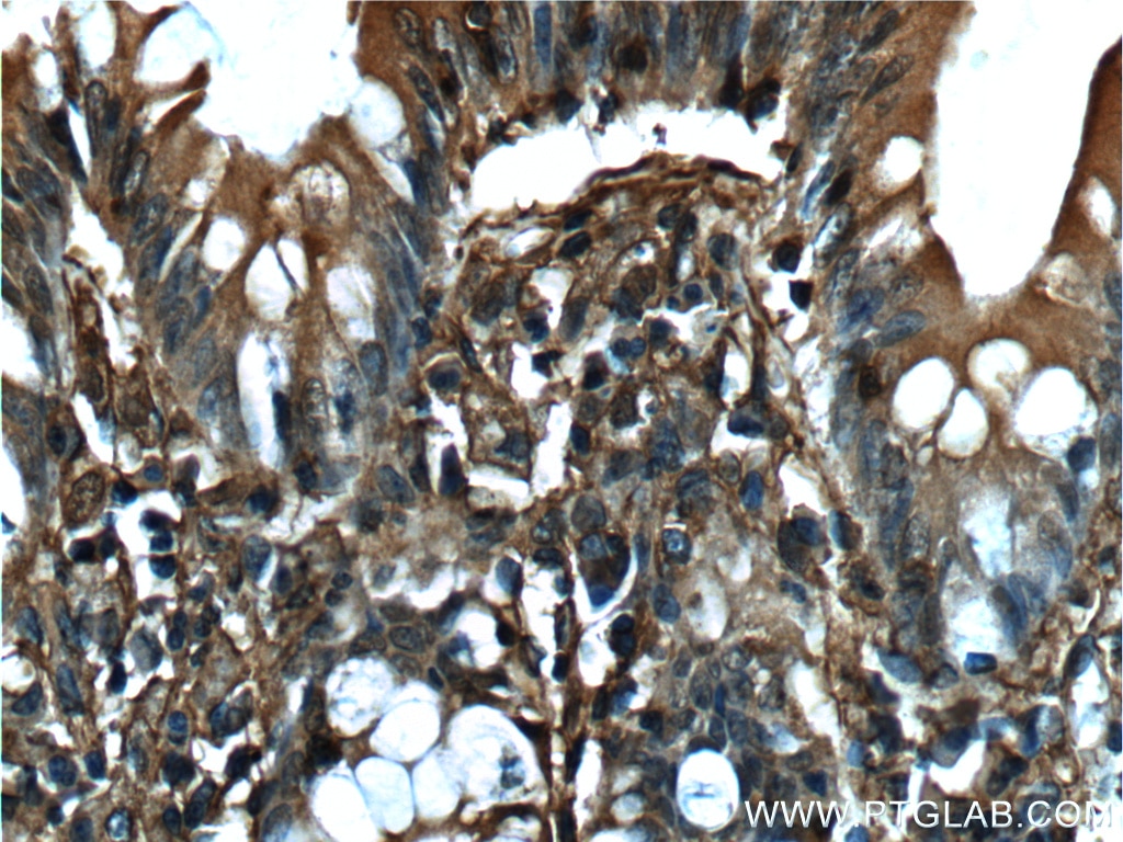 Immunohistochemistry (IHC) staining of human colon tissue using Annexin V Monoclonal antibody (66245-1-Ig)