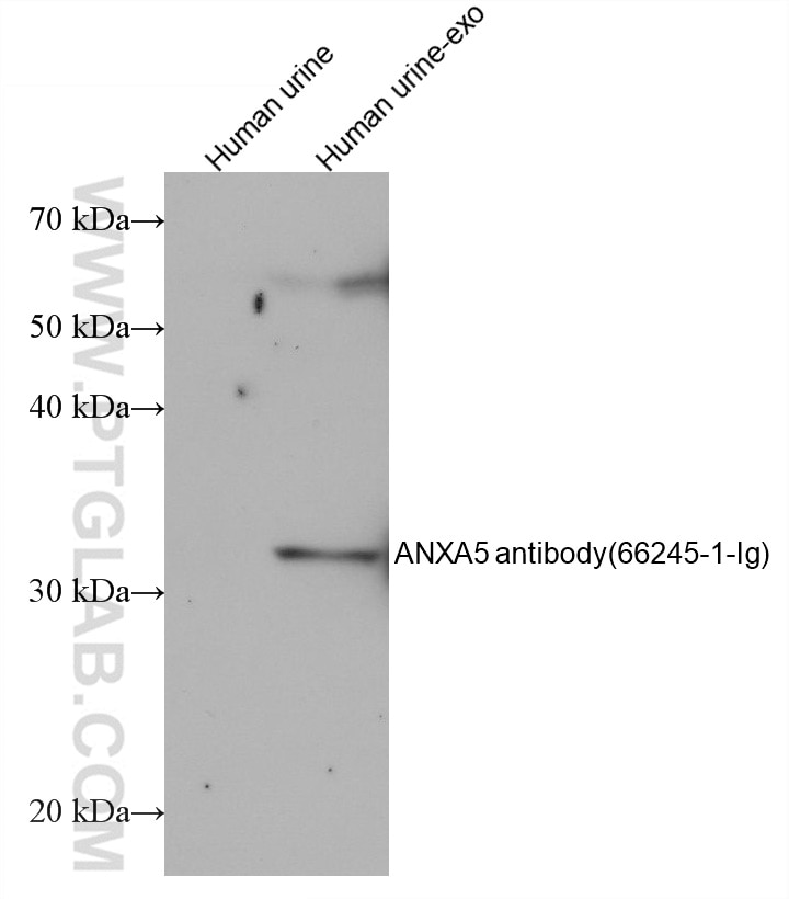 Western Blot (WB) analysis of various lysates using Annexin V Monoclonal antibody (66245-1-Ig)