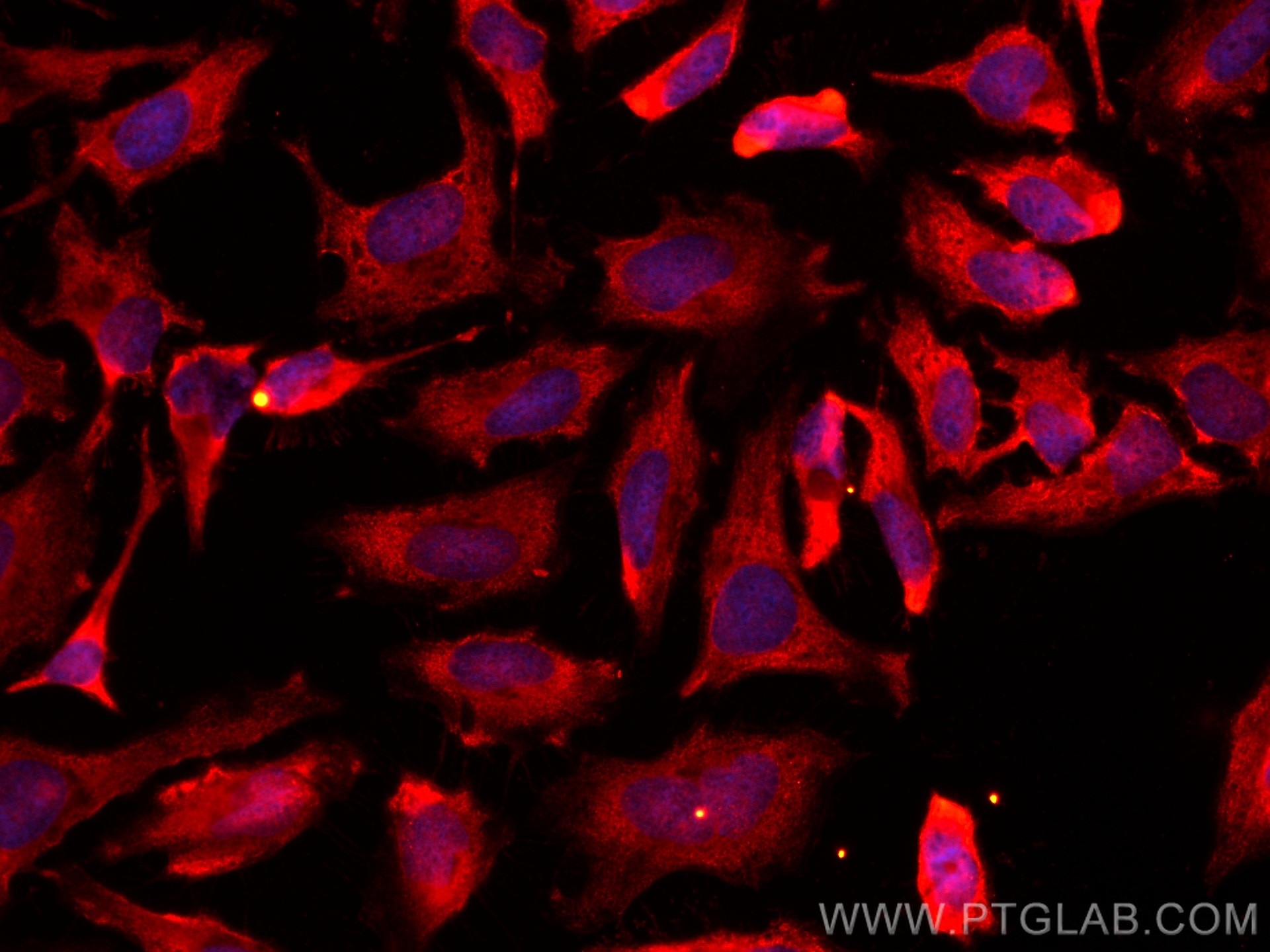Immunofluorescence (IF) / fluorescent staining of HeLa cells using CoraLite®594-conjugated Annexin V Monoclonal antib (CL594-66245)