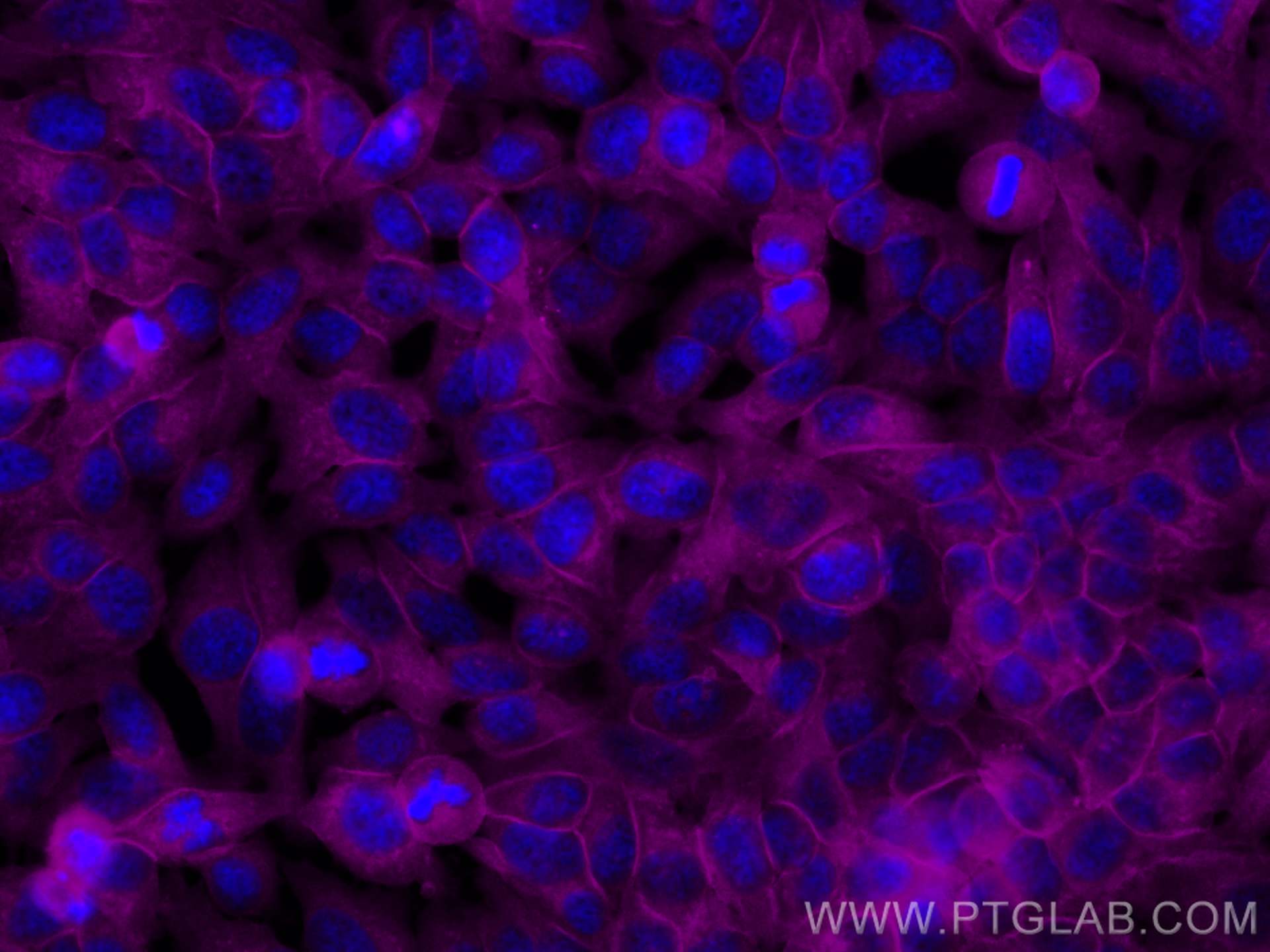 Immunofluorescence (IF) / fluorescent staining of HeLa cells using CoraLite® Plus 647-conjugated Annexin V Polyclonal (CL647-11060)