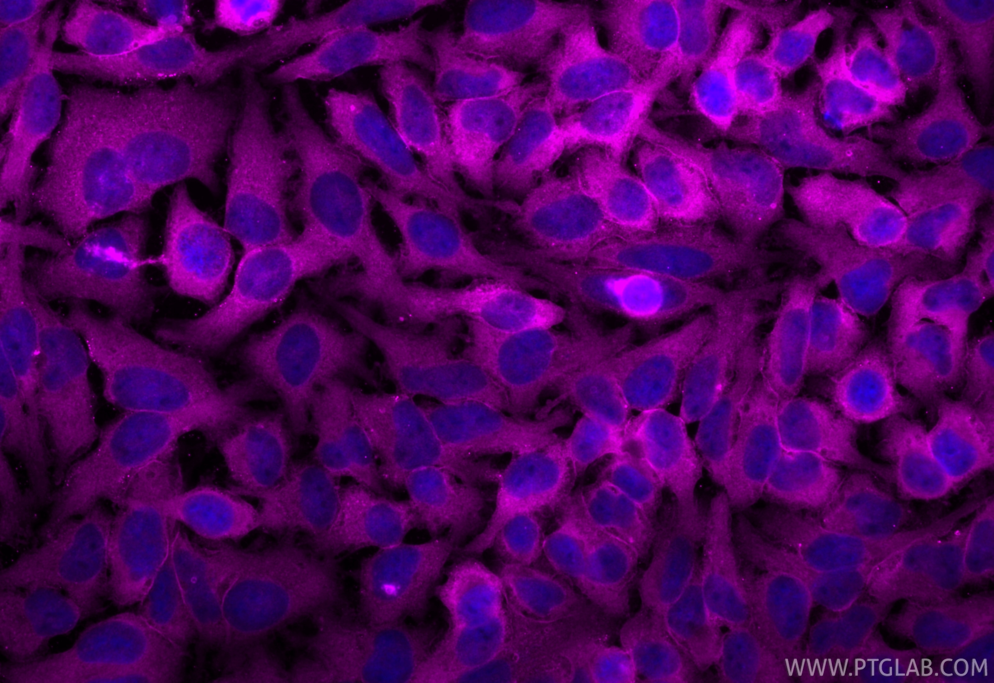 Immunofluorescence (IF) / fluorescent staining of HeLa cells using CoraLite® Plus 647-conjugated Annexin V Polyclonal (CL647-11060)