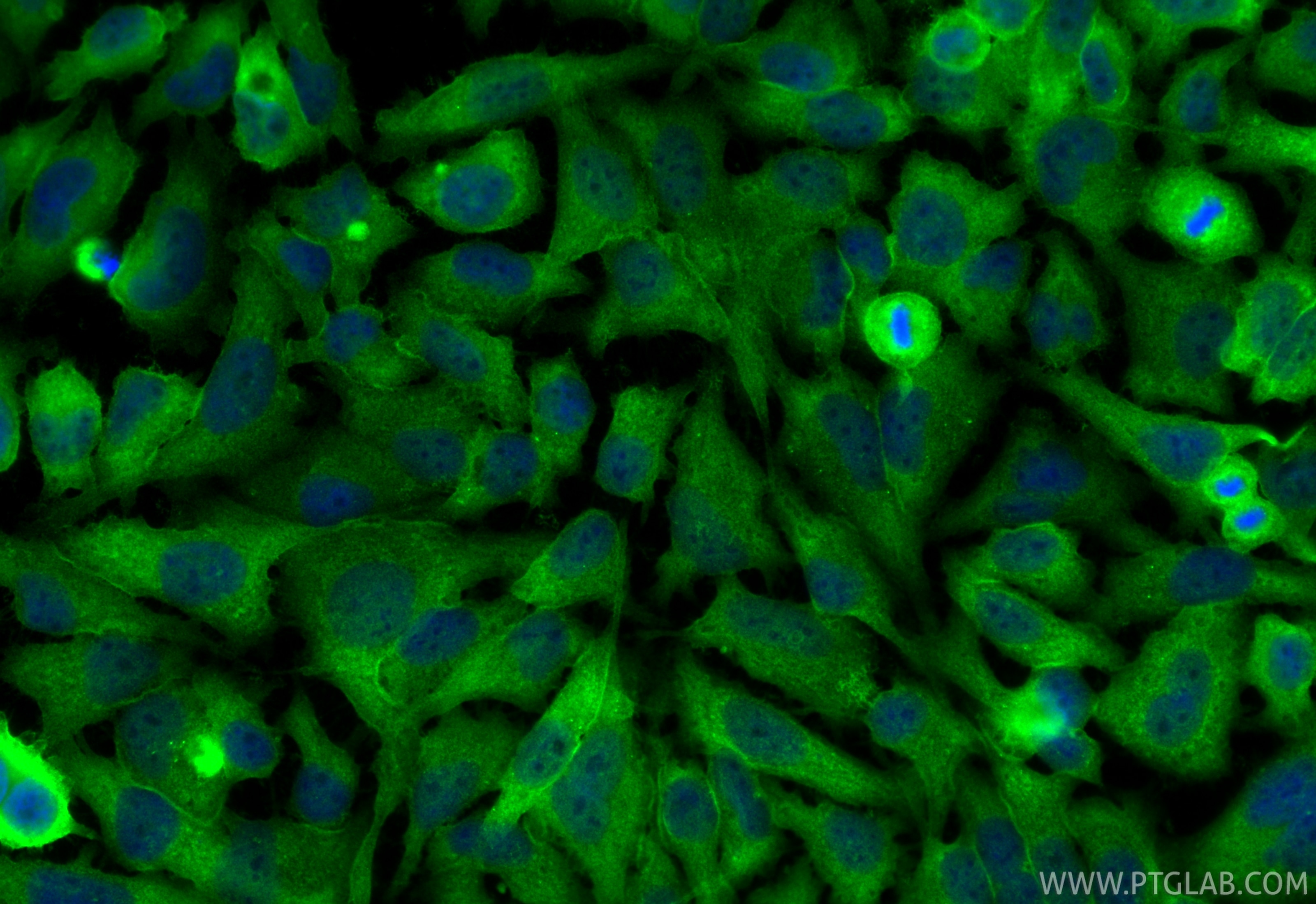 IF Staining of HeLa using RMX00072 Immunofluorescence (IF) / fluorescent staining of HeLa cells using Multi-rAb® Annexin V Multi-Recombinant antibody (RMX00072)