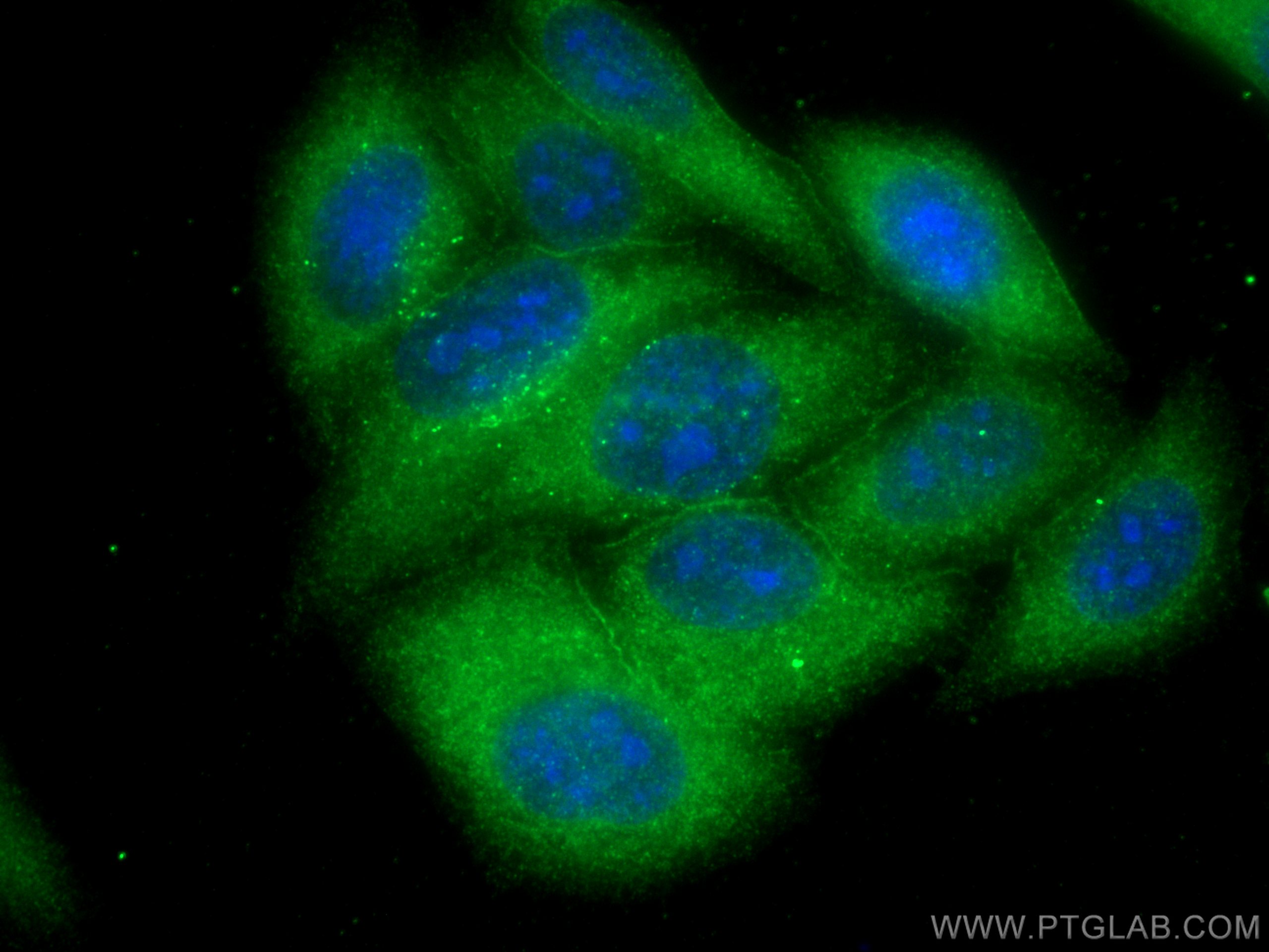 Immunofluorescence (IF) / fluorescent staining of HepG2 cells using Annexin VI Monoclonal antibody (68086-1-Ig)