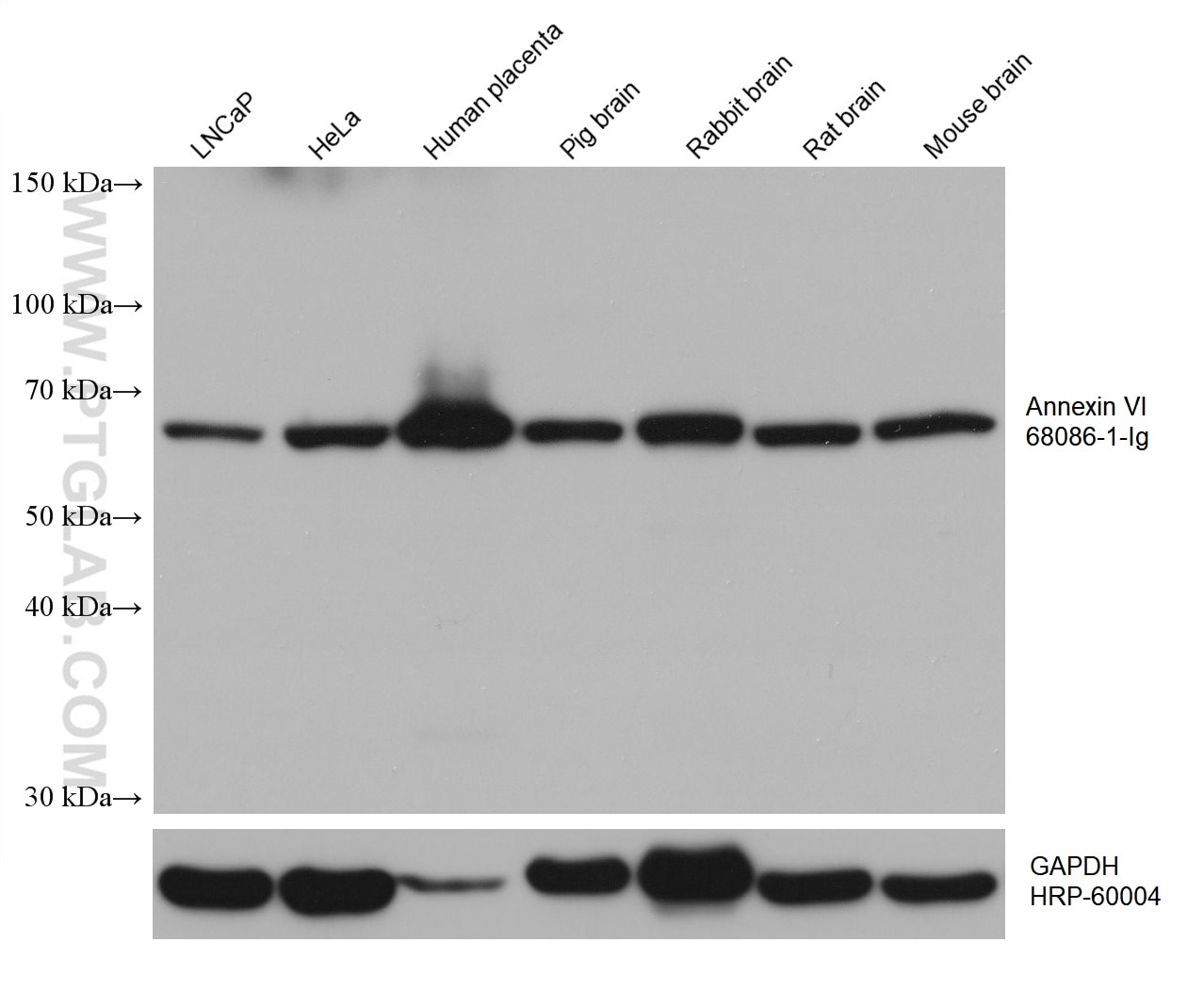 Western Blot (WB) analysis of various lysates using Annexin VI Monoclonal antibody (68086-1-Ig)