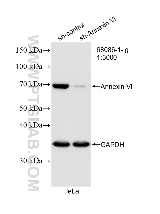 Western Blot (WB) analysis of HeLa cells using Annexin VI Monoclonal antibody (68086-1-Ig)
