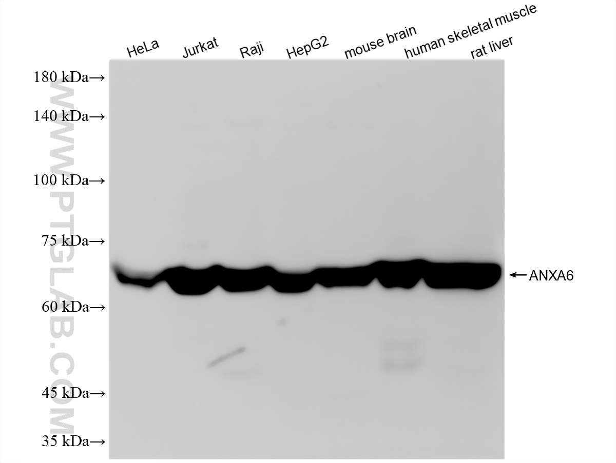 WB analysis using 87752-1-RR Western Blot (WB) analysis of various lysates using Annexin VI Recombinant monoclonal antibody (87752-1-RR)