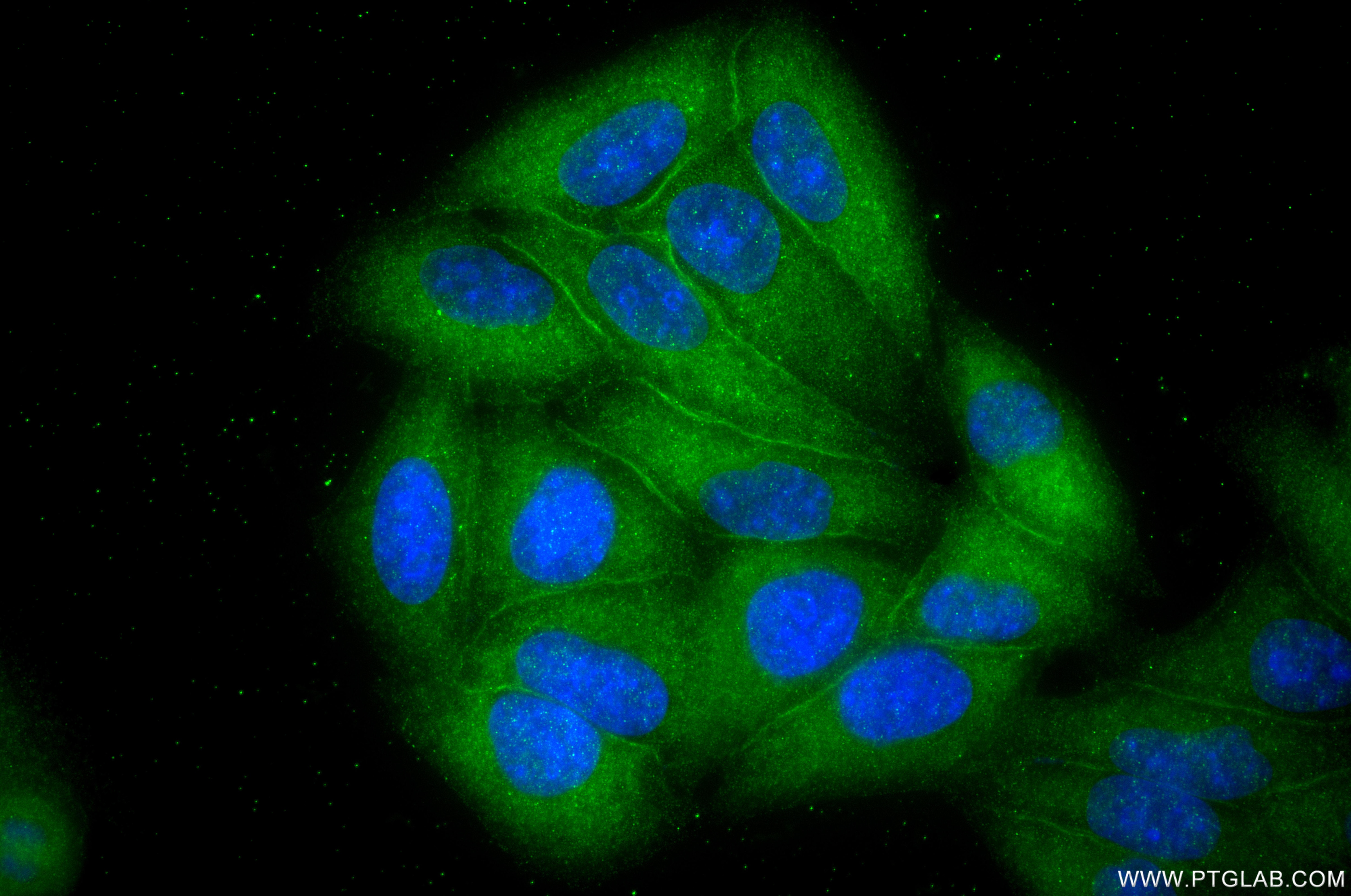 IF Staining of HepG2 using 87752-4-RR (same clone as 87752-4-PBS) Immunofluorescence (IF) / fluorescent staining of HepG2 cells using Annexin VI Recombinant monoclonal antibody (87752-4-RR)