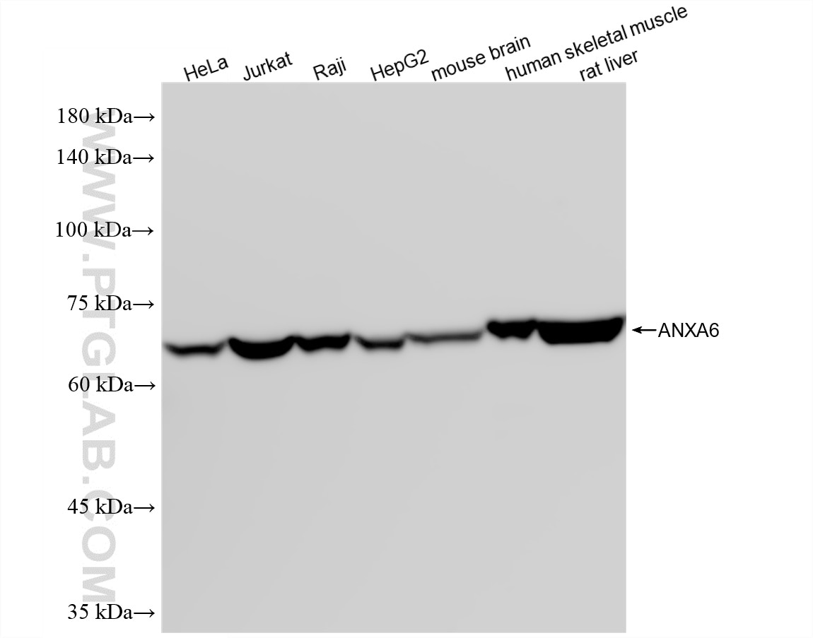 WB analysis using 87752-4-RR (same clone as 87752-4-PBS) Western Blot (WB) analysis of various lysates using Annexin VI Recombinant monoclonal antibody (87752-4-RR)