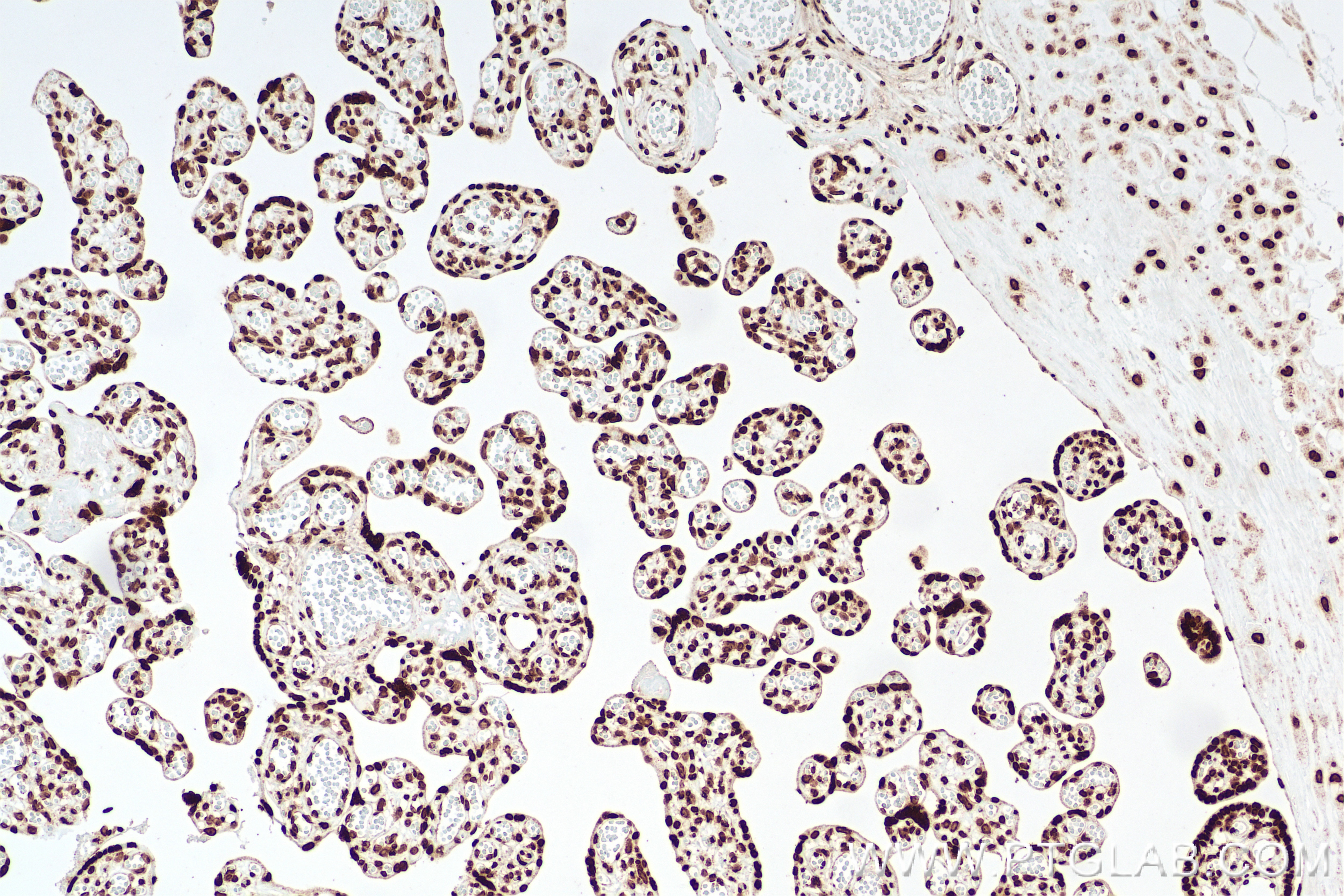 Immunohistochemistry (IHC) staining of human placenta tissue using Anti-DNA Recombinant antibody (85854-1-RR)