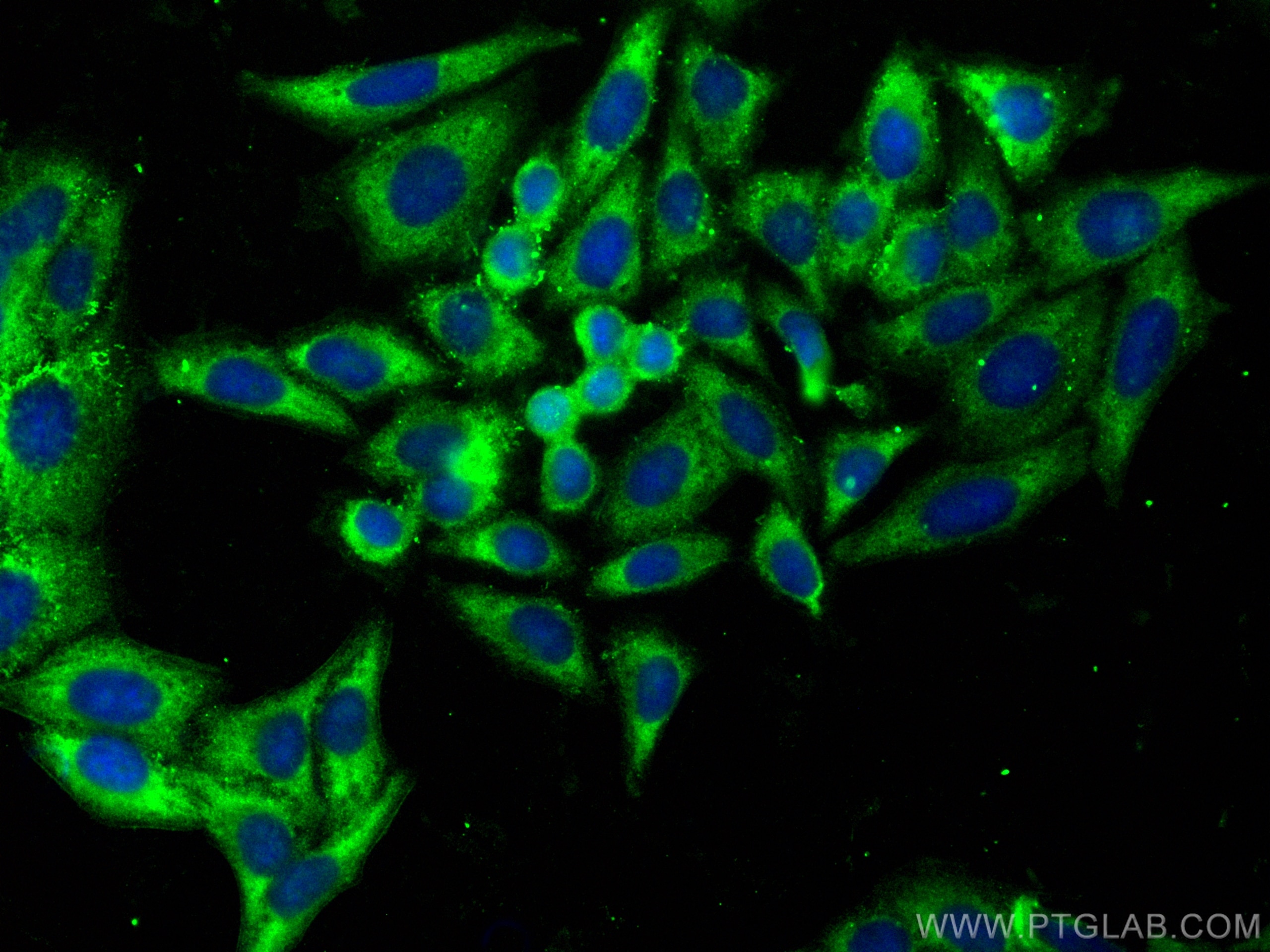 Apolipoprotein A II