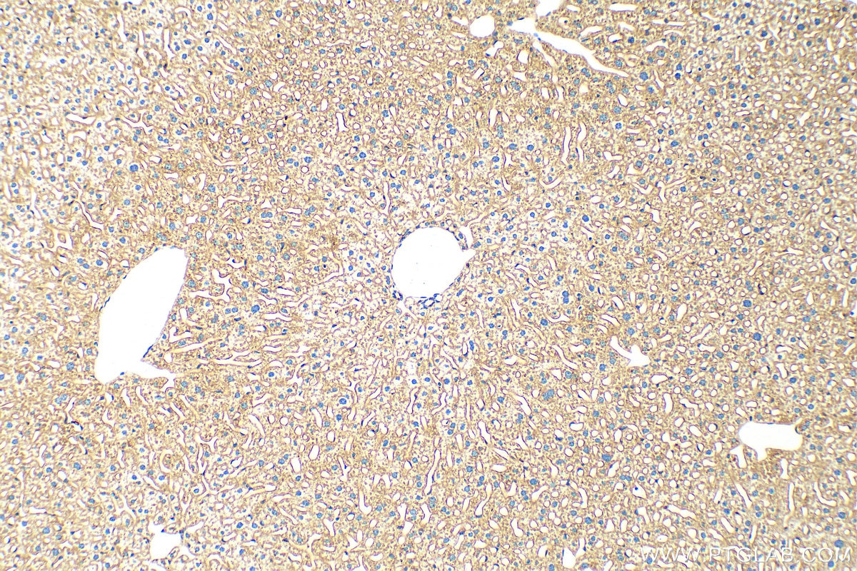 Immunohistochemistry (IHC) staining of mouse liver tissue using Apoe Recombinant antibody (83728-4-RR)