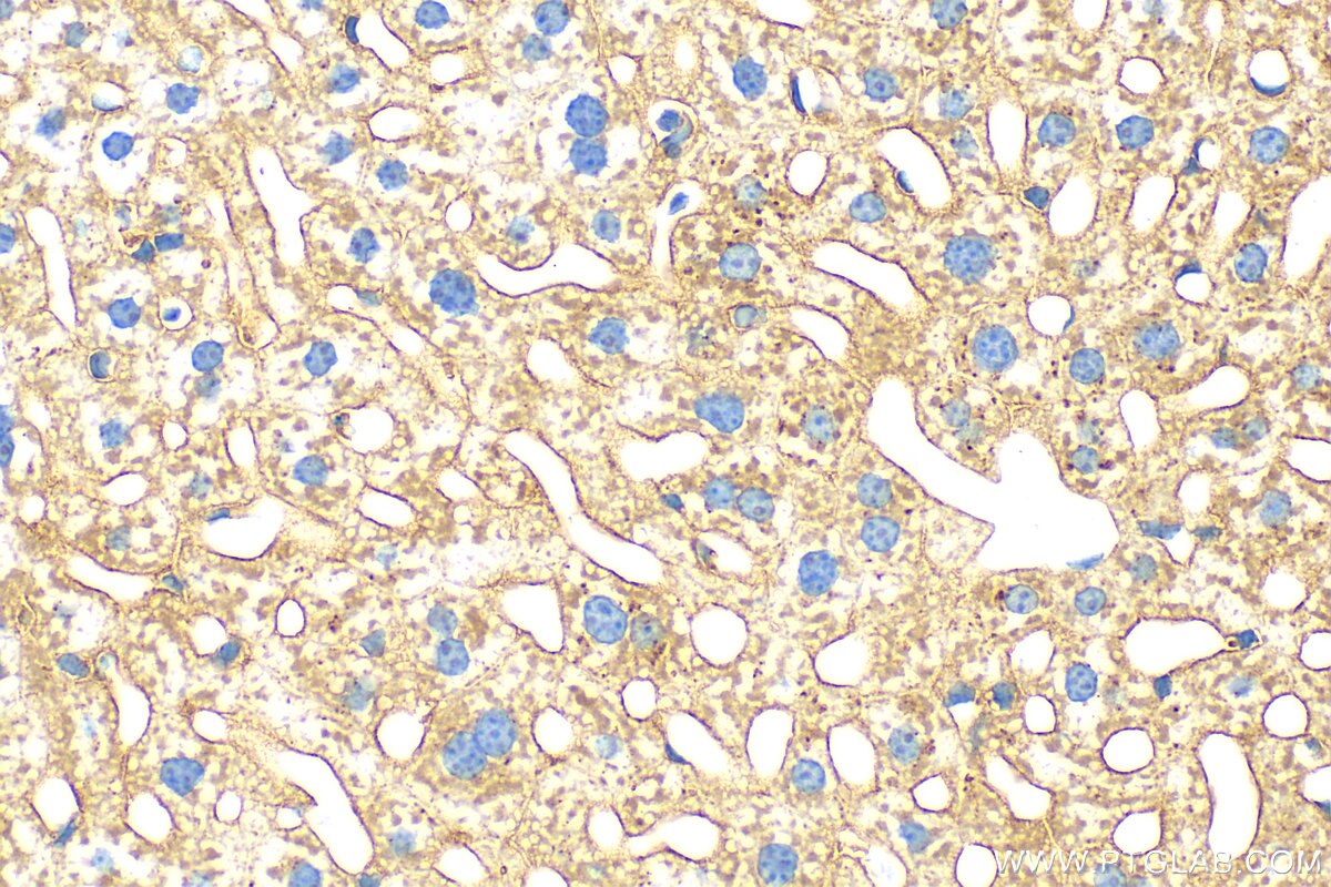 Immunohistochemistry (IHC) staining of mouse liver tissue using Apoe Recombinant antibody (83728-4-RR)