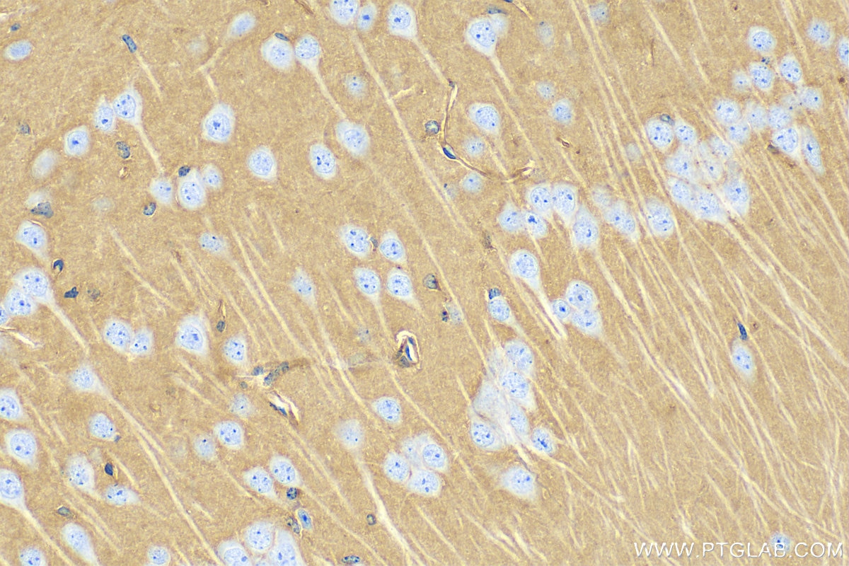 Immunohistochemistry (IHC) staining of mouse brain tissue using Apoe Recombinant antibody (83728-4-RR)