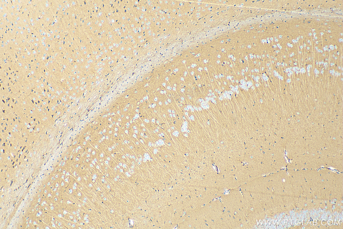 Immunohistochemistry (IHC) staining of mouse brain tissue using Apoe Recombinant antibody (83728-4-RR)