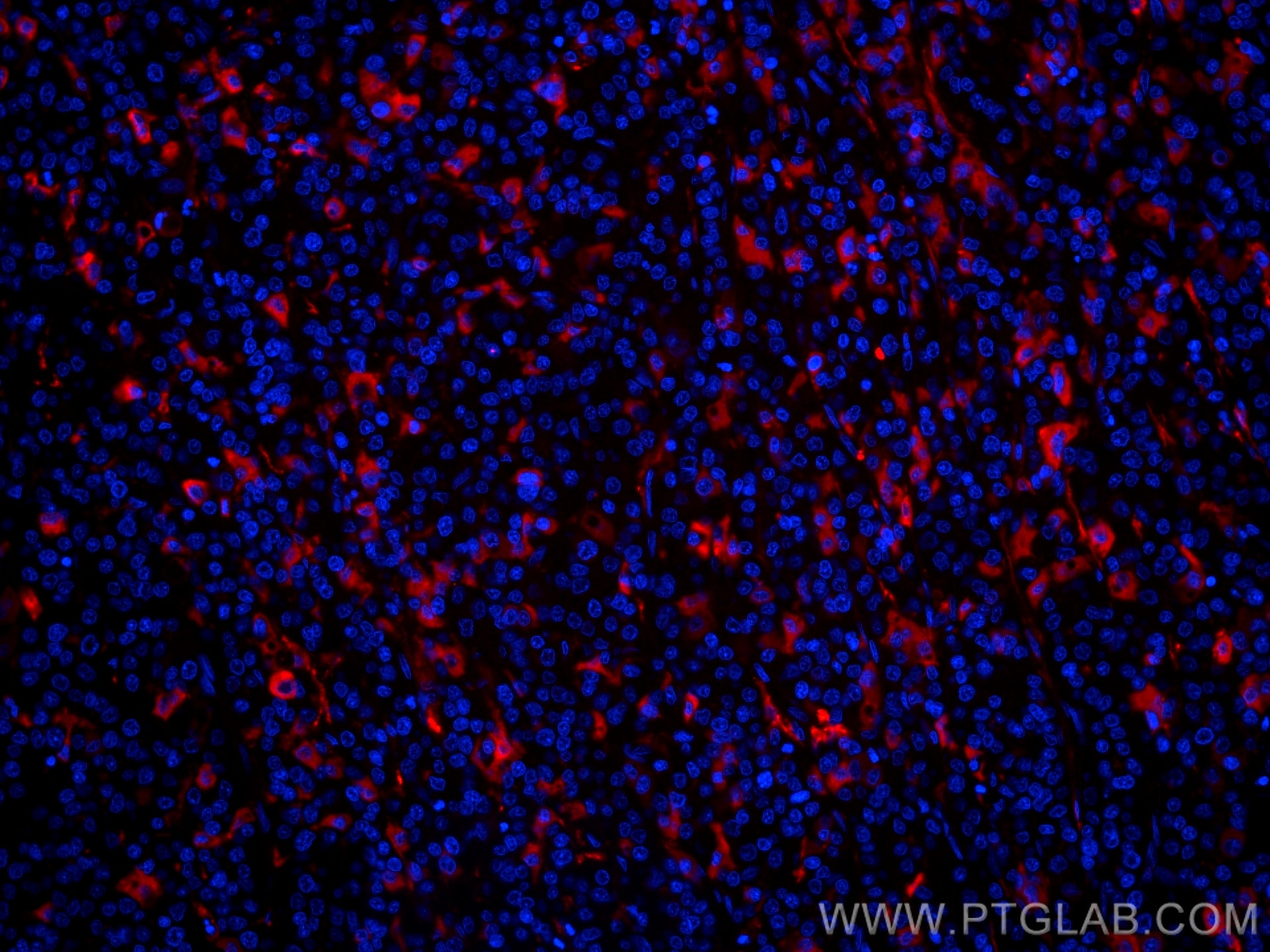 Apolipoprotein H