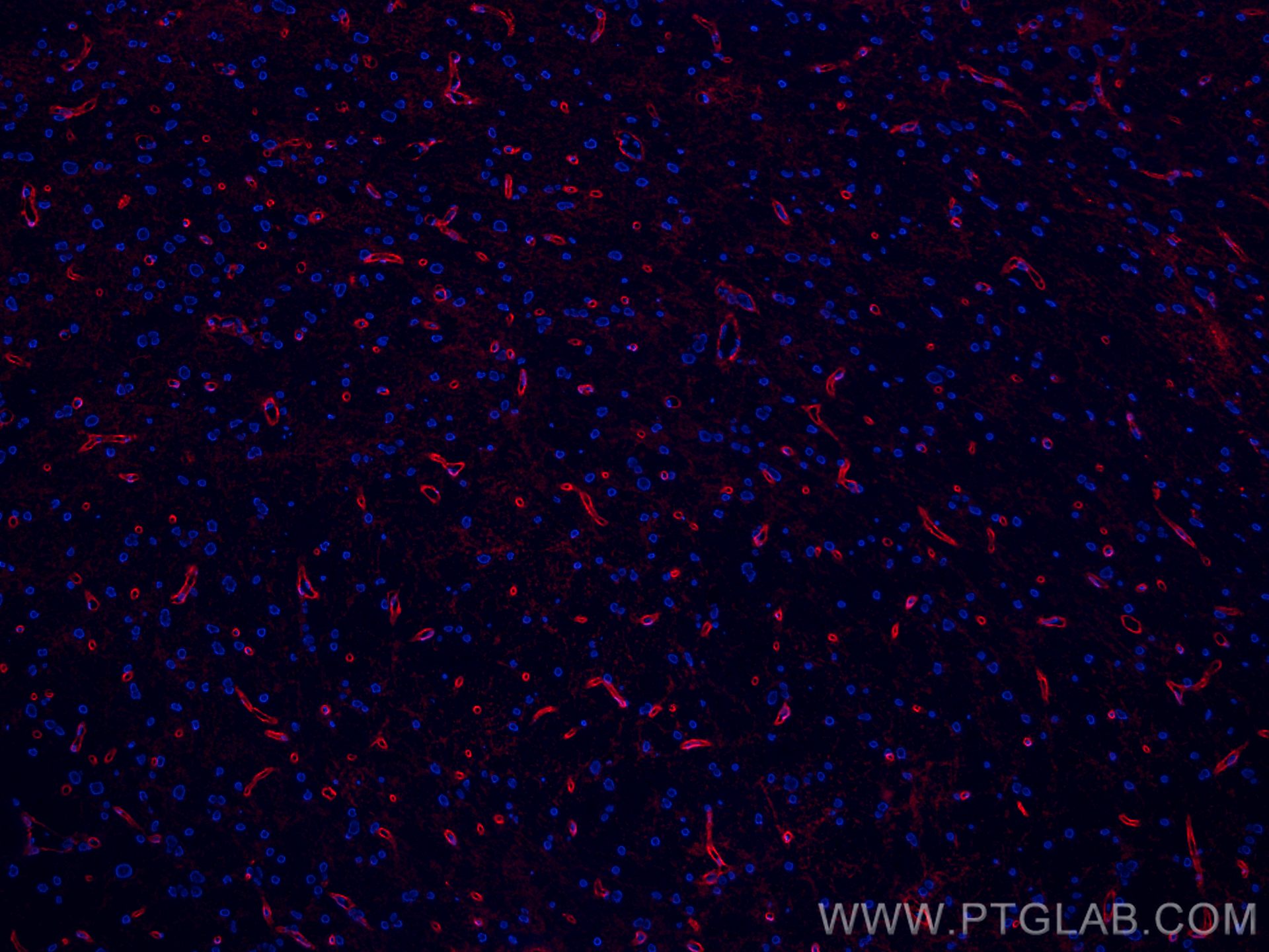 Immunofluorescence (IF) / fluorescent staining of rat brain tissue using CoraLite®594-conjugated Aquaporin 4 Polyclonal ant (CL594-16473)