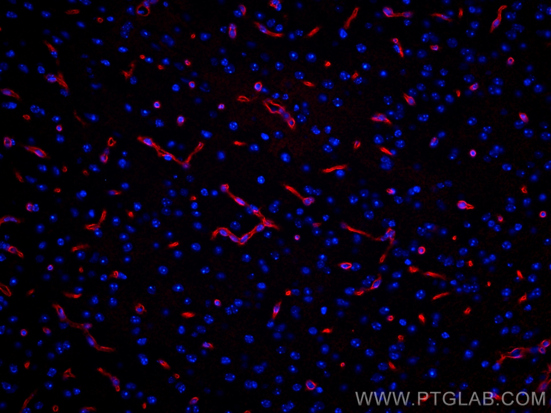 Immunofluorescence (IF) / fluorescent staining of mouse brain tissue using CoraLite®594-conjugated Aquaporin 4 Polyclonal ant (CL594-16473)