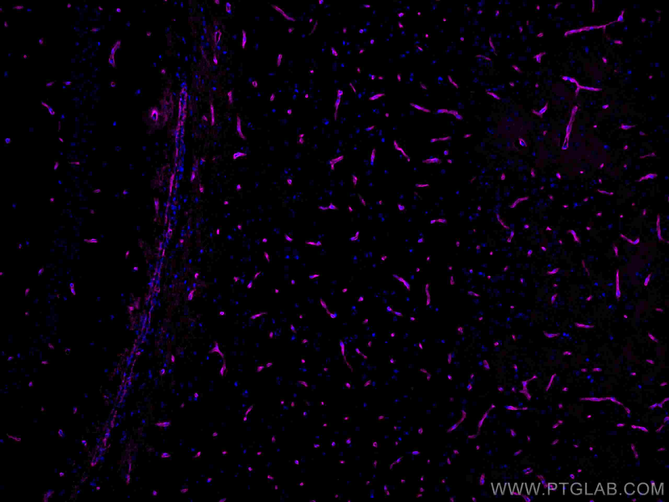 Immunofluorescence (IF) / fluorescent staining of mouse brain tissue using CoraLite® Plus 647-conjugated Aquaporin 4 Polyclon (CL647-16473)