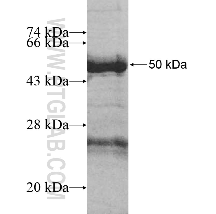 Ard1 fusion protein Ag11439 SDS-PAGE