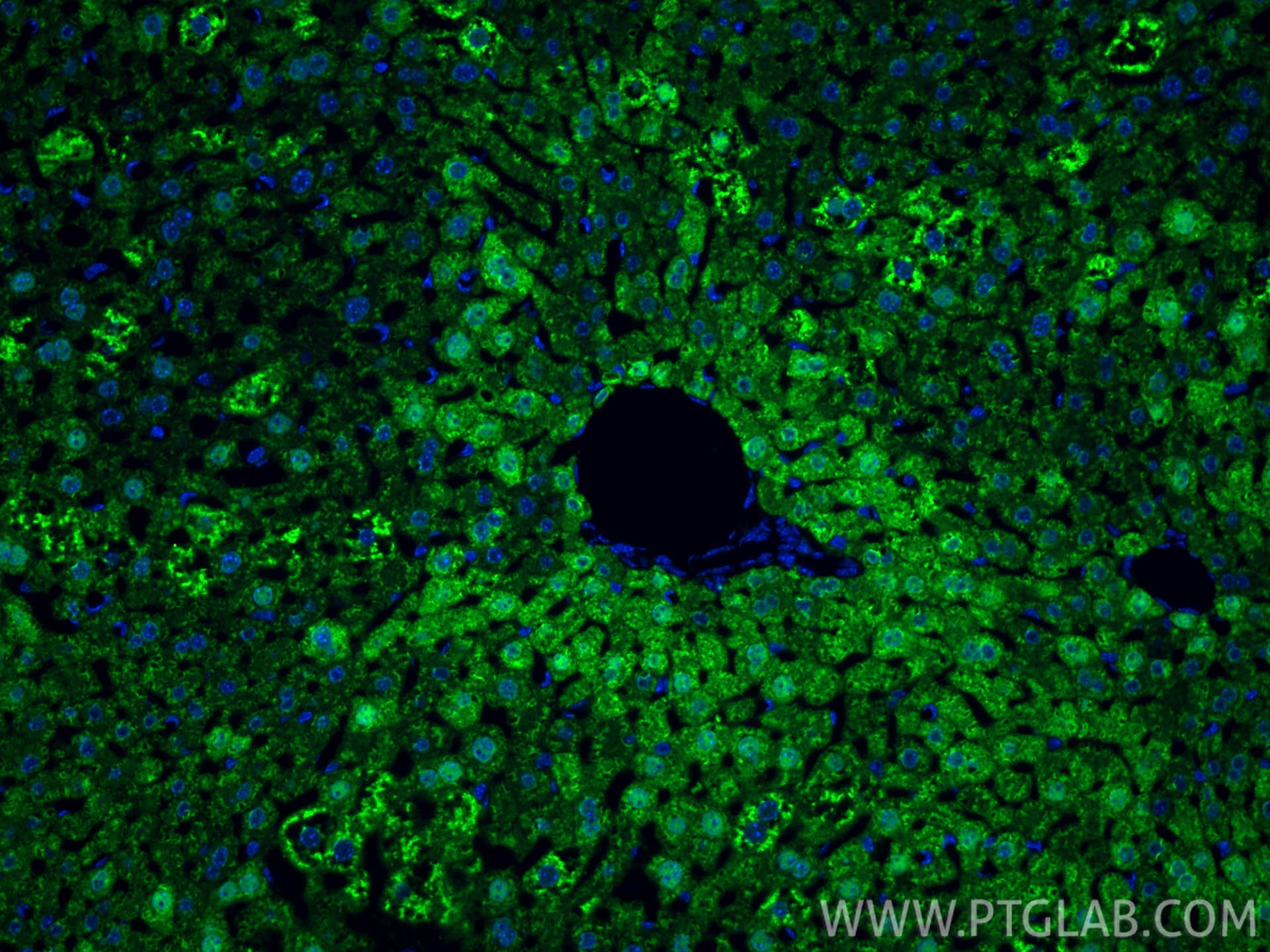 Immunofluorescence (IF) / fluorescent staining of mouse liver tissue using Arginase-1 Recombinant monoclonal antibody (82975-1-RR)