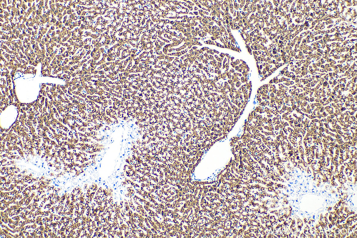 Immunohistochemistry (IHC) staining of mouse liver tissue using Arginase-1 Recombinant antibody (82975-1-RR)