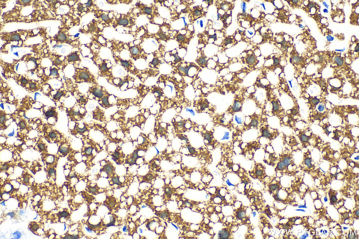 Immunohistochemistry (IHC) staining of mouse liver tissue using Arginase-1 Recombinant antibody (82975-1-RR)