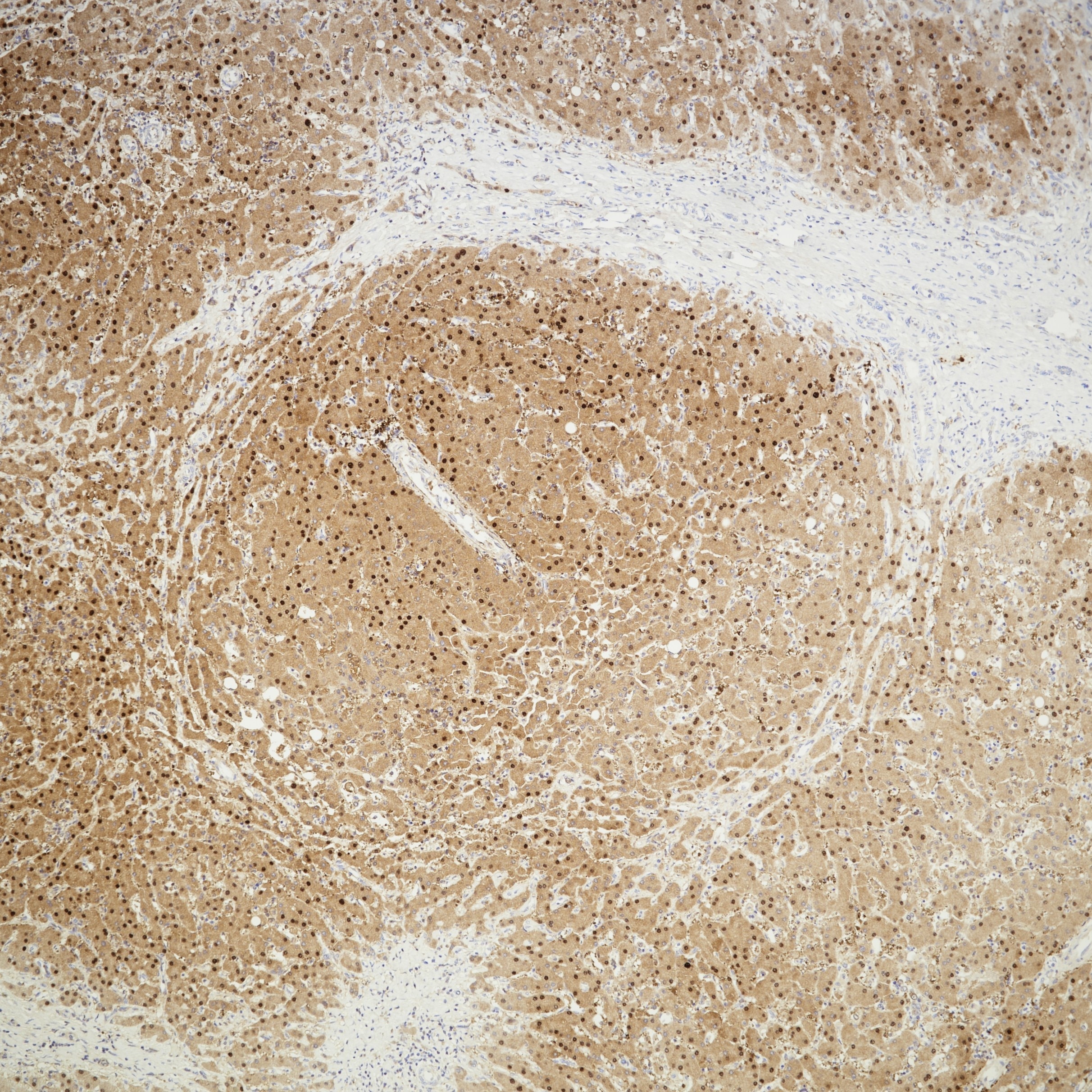 Immunohistochemistry (IHC) staining of human liver tissue using Arginase-1 Recombinant monoclonal antibody (82975-1-RR)