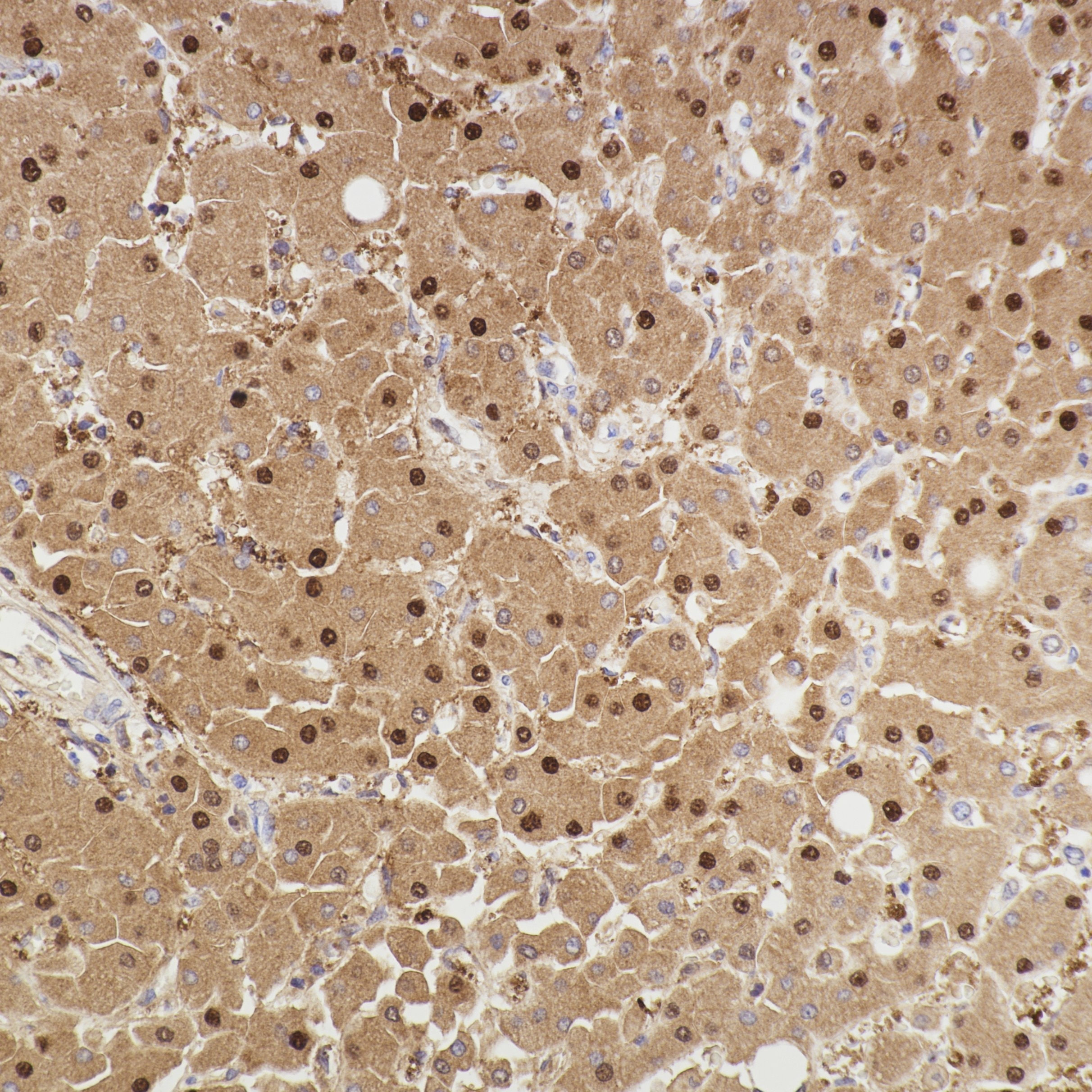 Immunohistochemistry (IHC) staining of human liver tissue using Arginase-1 Recombinant monoclonal antibody (82975-1-RR)