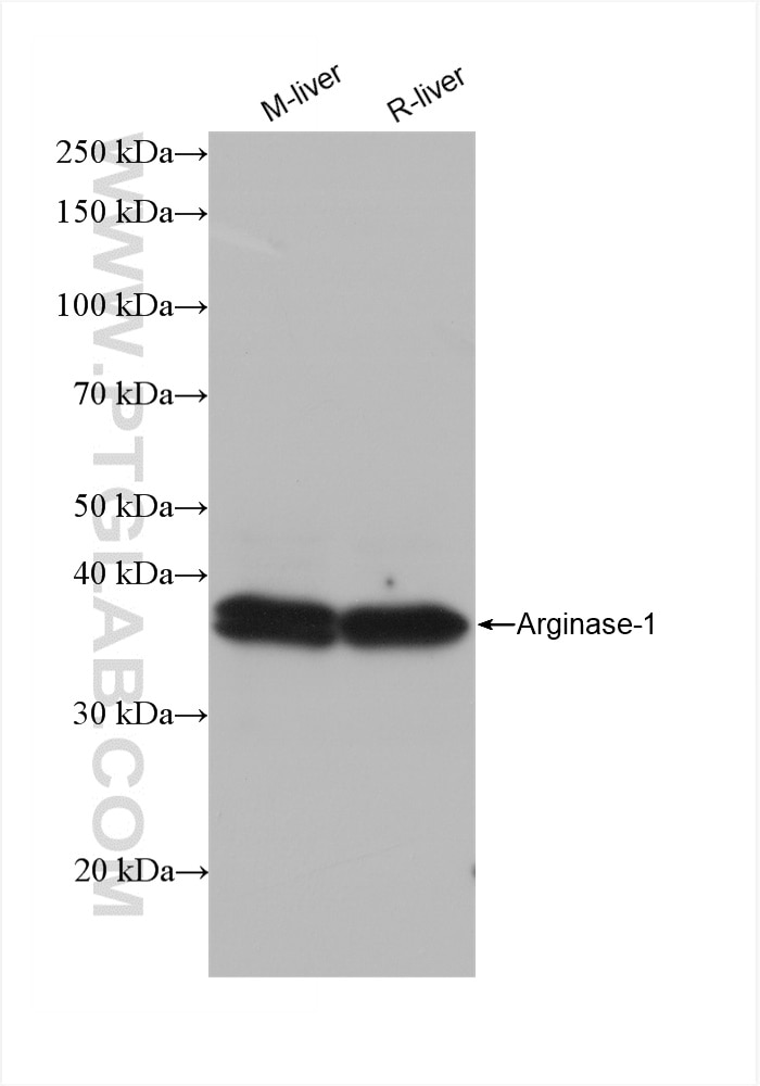 Western Blot (WB) analysis of various lysates using human Arginase-1 Recombinant antibody (82975-1-RR)