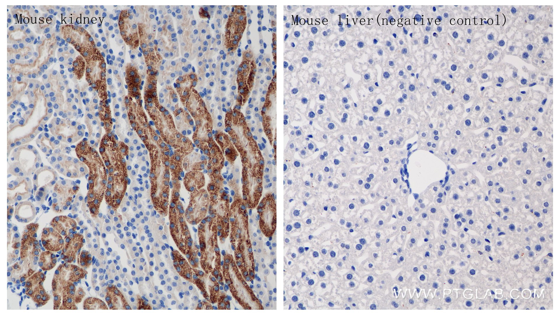 Immunohistochemistry (IHC) staining of mouse kidney tissue using Arginase-2 Recombinant antibody (84808-5-RR)