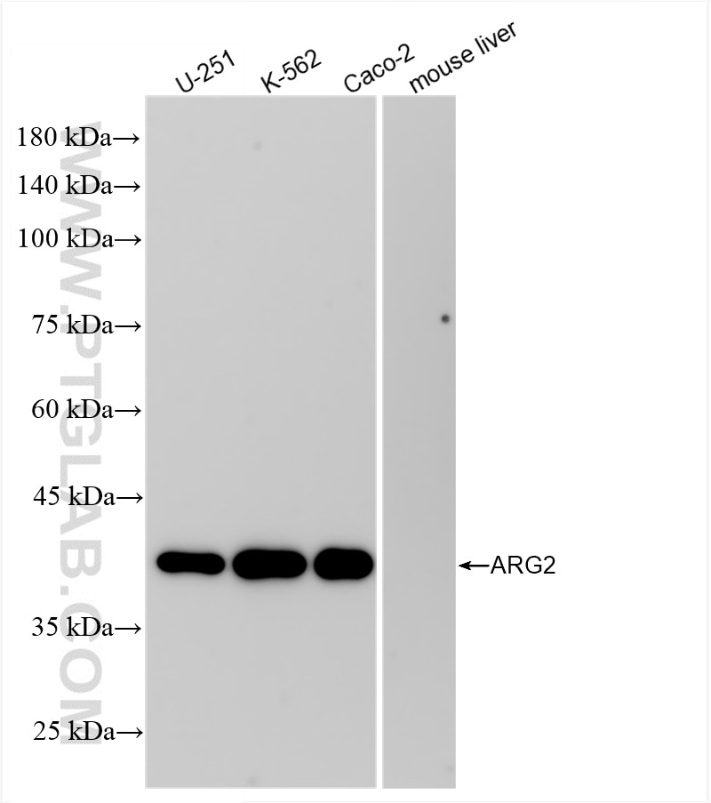 Arginase-2