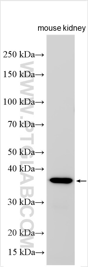 Western Blot (WB) analysis of various lysates using Arginase-2 Recombinant antibody (84808-5-RR)