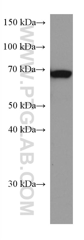 WB analysis of pig skeletal muscle using 67326-1-Ig