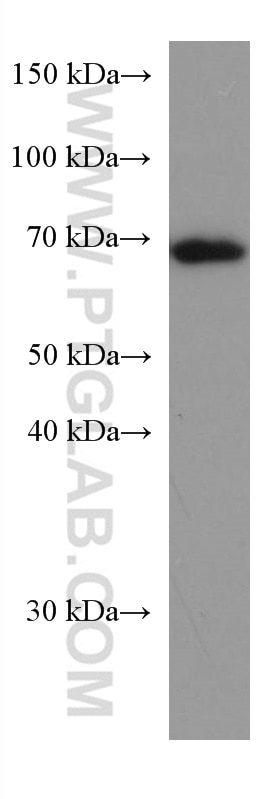 Western Blot (WB) analysis of rat skeletal muscle tissue using Arp5/ACTR5 Monoclonal antibody (67326-1-Ig)