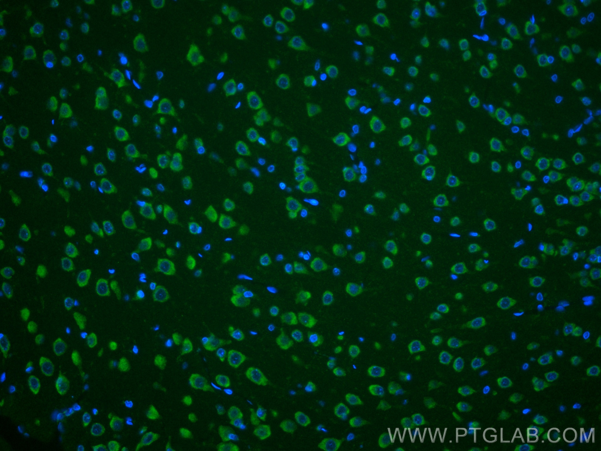 Immunofluorescence (IF) / fluorescent staining of rat brain tissue using Ataxin 2 Monoclonal antibody (68316-1-Ig)