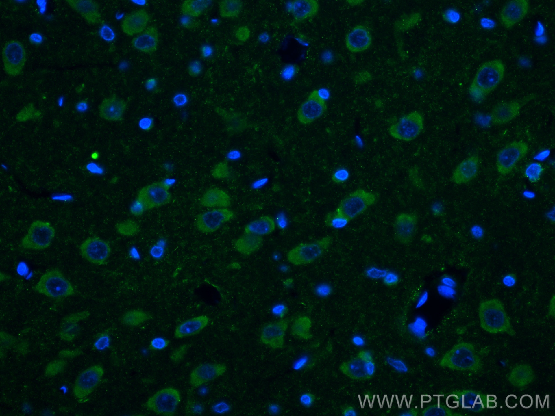 Immunofluorescence (IF) / fluorescent staining of rat brain tissue using Ataxin 2 Monoclonal antibody (68316-1-Ig)