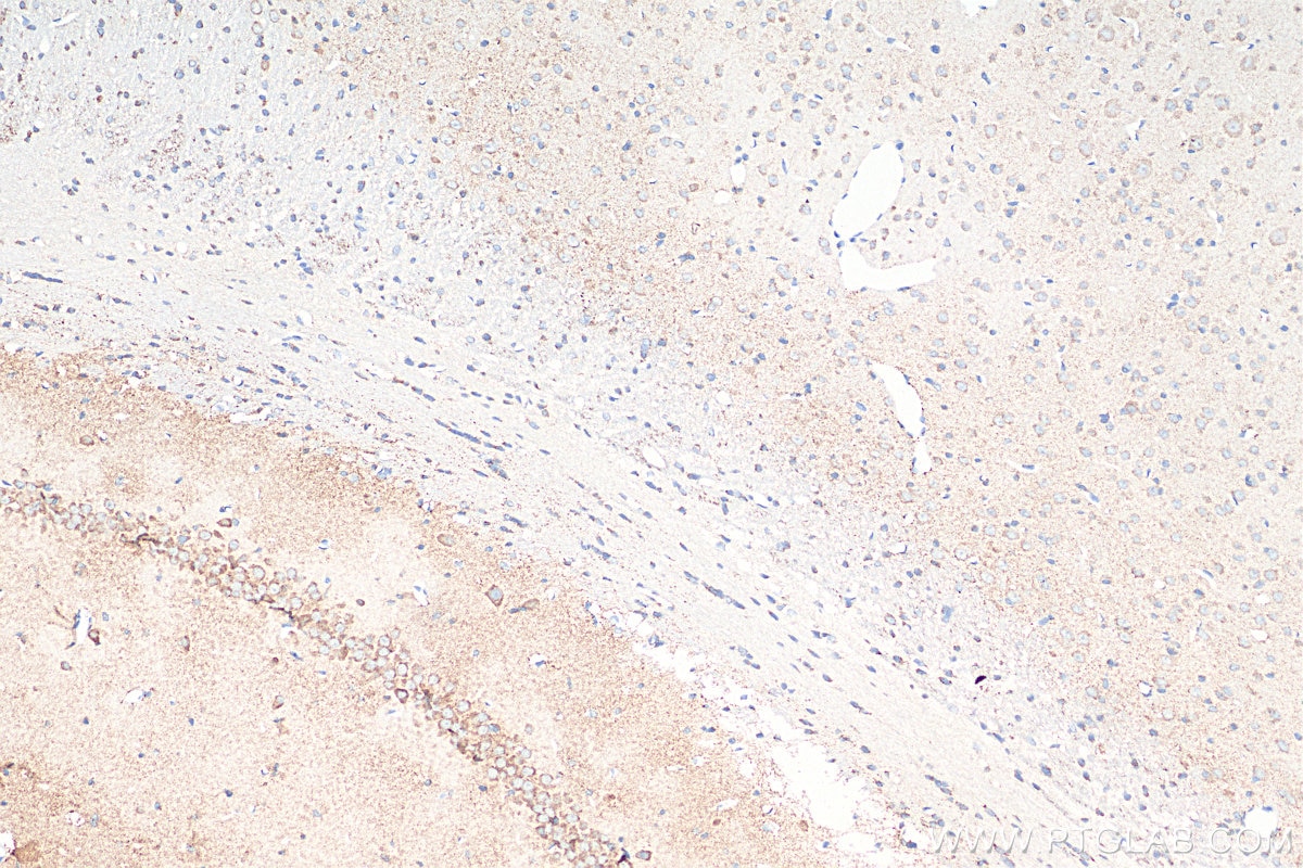 Immunohistochemistry (IHC) staining of rat brain tissue using Ataxin 2 Monoclonal antibody (68316-1-Ig)