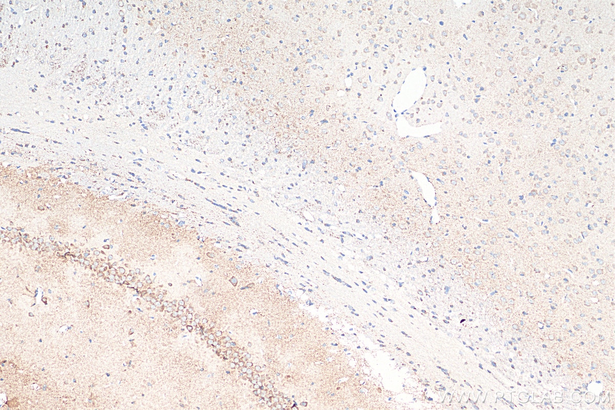 IHC staining of rat brain using 68316-1-Ig