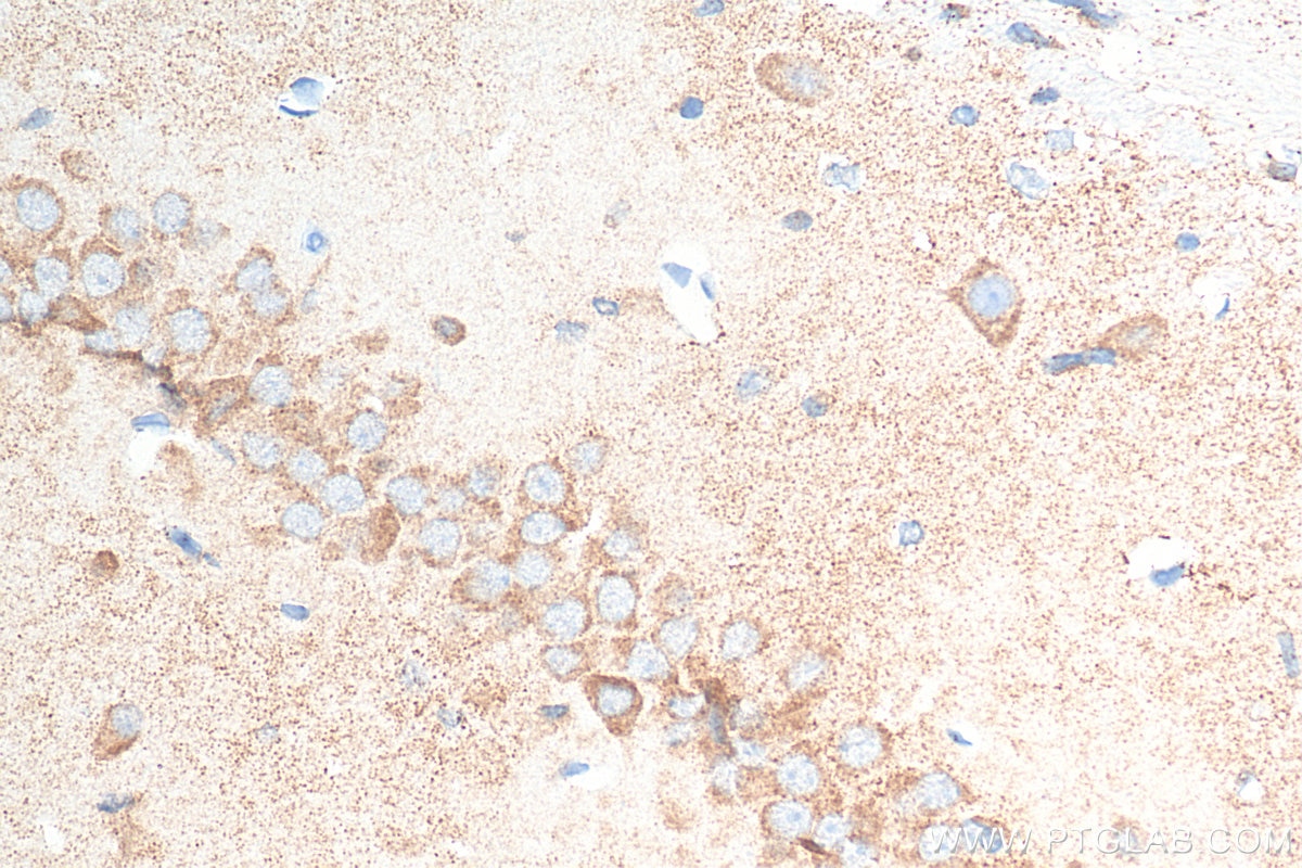 Immunohistochemistry (IHC) staining of rat brain tissue using Ataxin 2 Monoclonal antibody (68316-1-Ig)