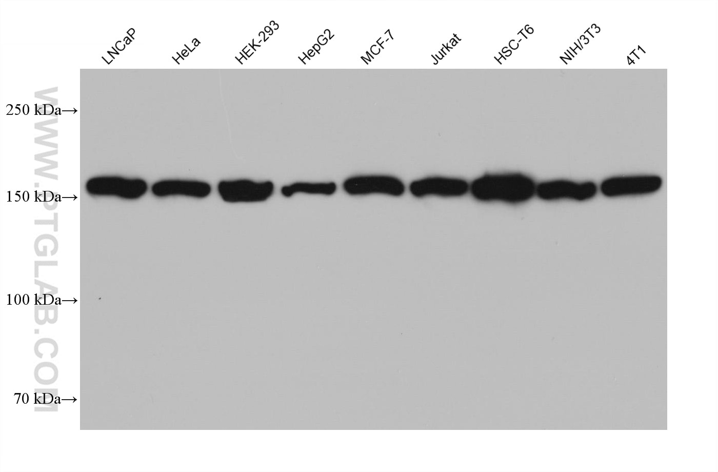 Western Blot (WB) analysis of various lysates using Ataxin 2 Monoclonal antibody (68316-1-Ig)