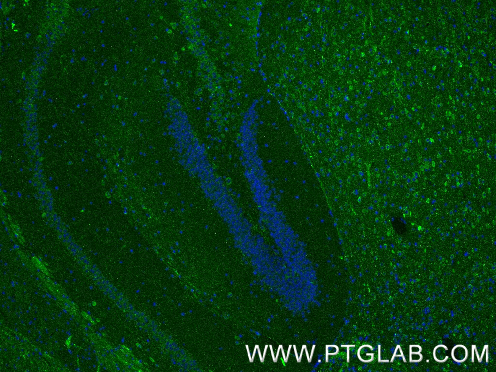 Immunofluorescence (IF) / fluorescent staining of mouse brain tissue using Ataxin 2 Recombinant antibody (80919-2-RR)