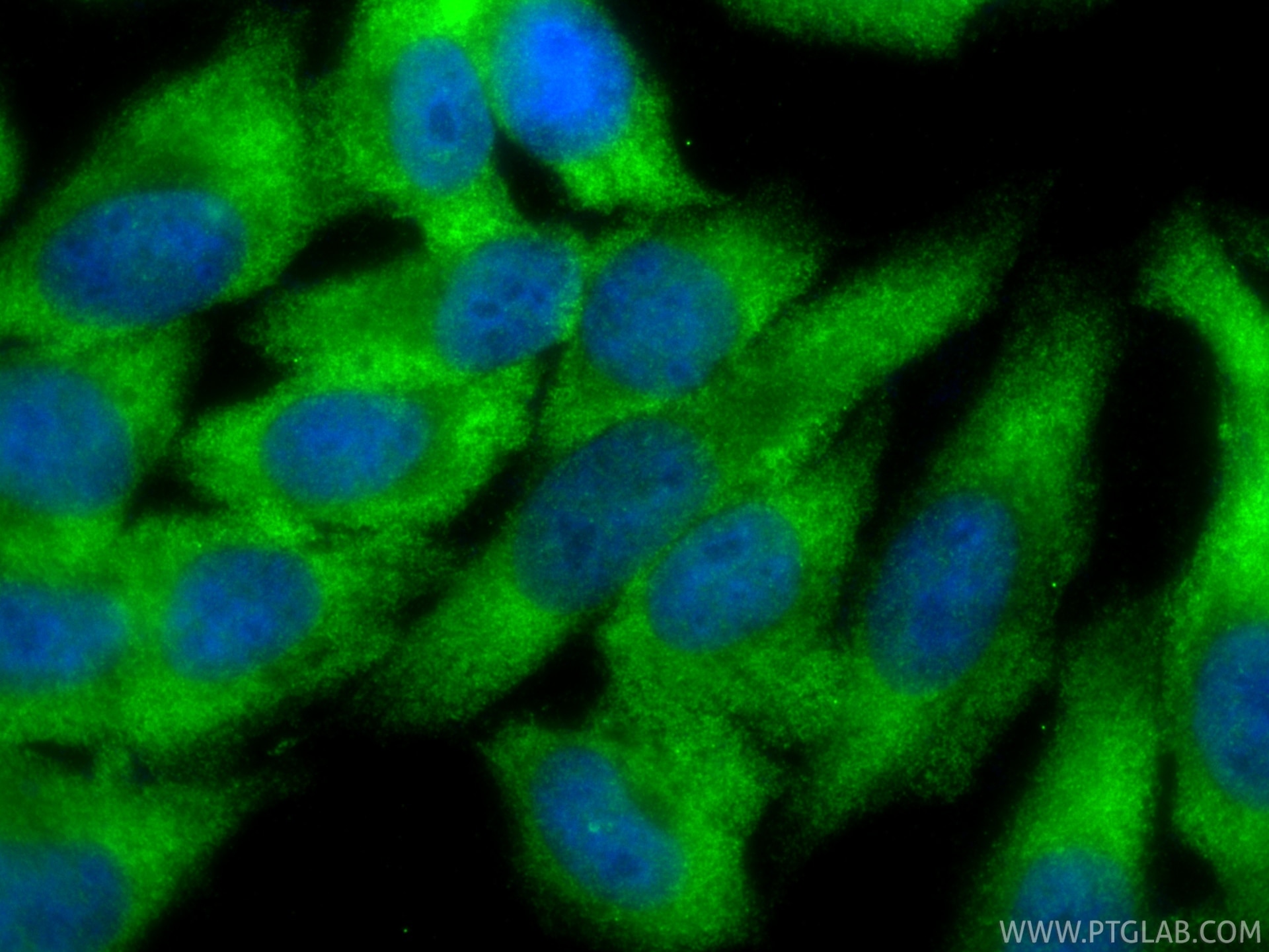 Immunofluorescence (IF) / fluorescent staining of HepG2 cells using Ataxin 2 Recombinant monoclonal antibody (80919-2-RR)