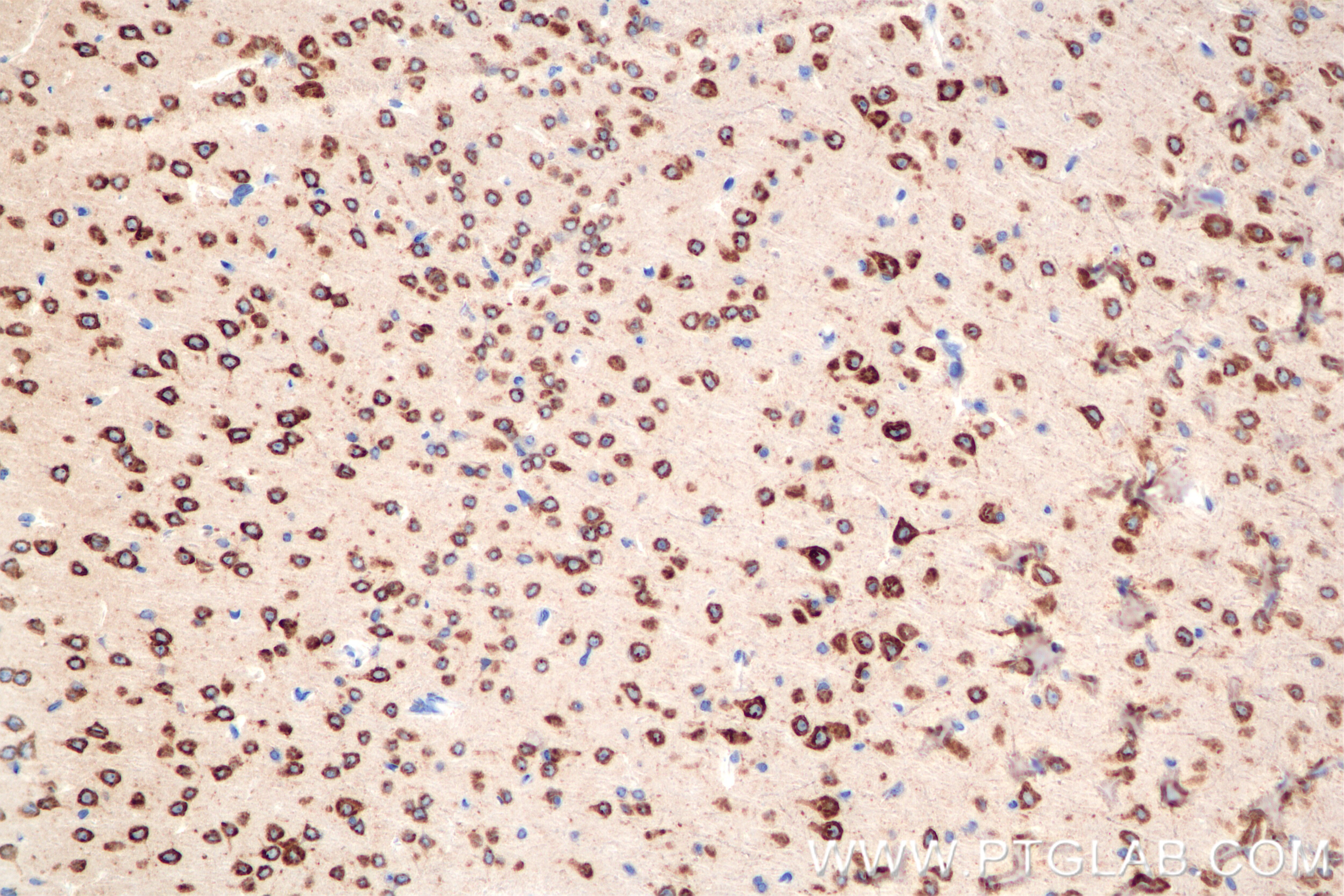 Immunohistochemistry (IHC) staining of mouse brain tissue using Ataxin 2 Recombinant antibody (80919-2-RR)