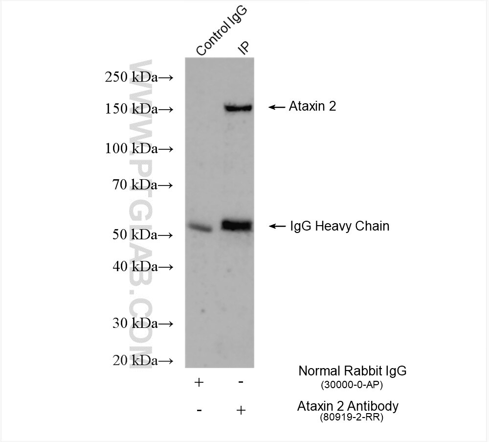 Immunoprecipitation (IP) experiment of NIH/3T3 cells using Ataxin 2 Recombinant antibody (80919-2-RR)