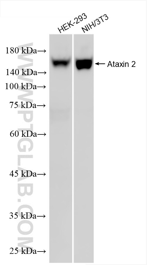 Western Blot (WB) analysis of various lysates using Ataxin 2 Recombinant antibody (80919-2-RR)