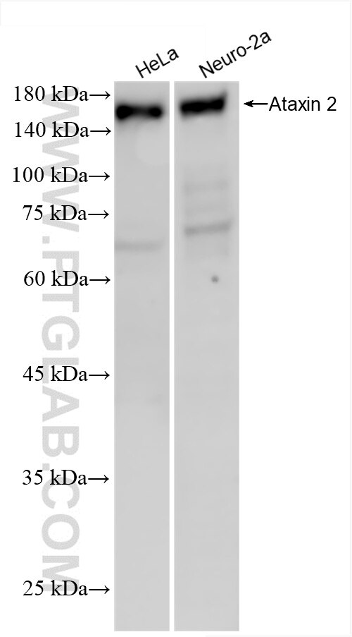 Western Blot (WB) analysis of various lysates using Ataxin 2 Recombinant antibody (80919-2-RR)