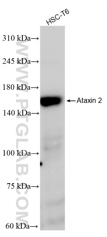 Western Blot (WB) analysis of HSC-T6 cells using Ataxin 2 Recombinant monoclonal antibody (80919-2-RR)