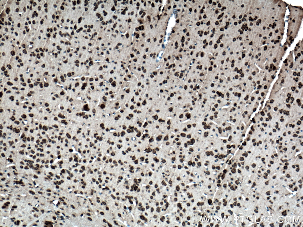 Immunohistochemistry (IHC) staining of mouse brain tissue using Biotin-conjugated Ataxin 2 Polyclonal antibody (Biotin-21776)