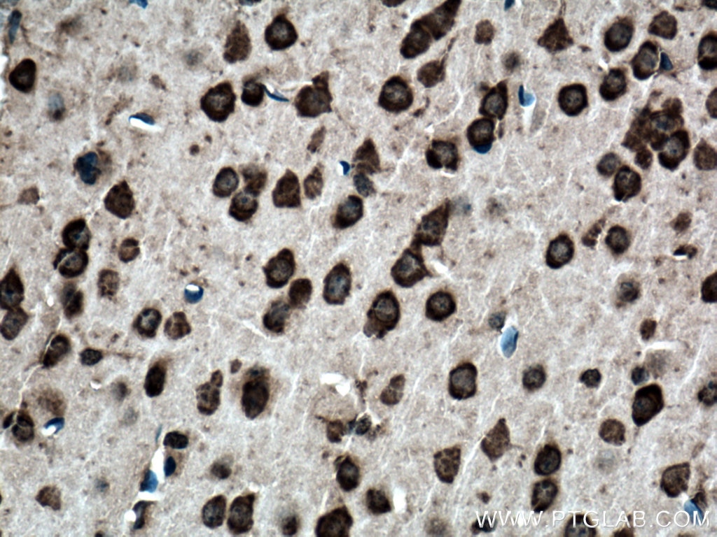 IHC staining of mouse brain using Biotin-21776