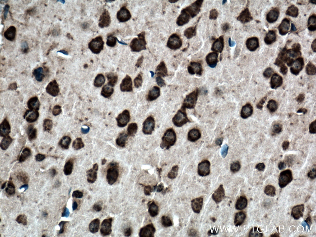 Biotin-conjugated Ataxin 2 Polyclonal antibody